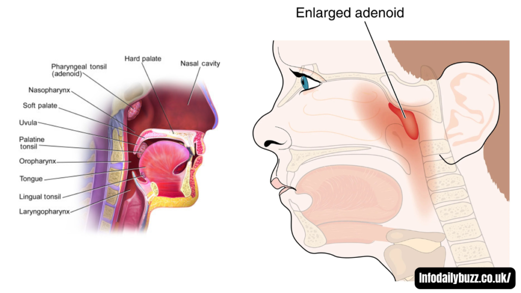 Adenoidid